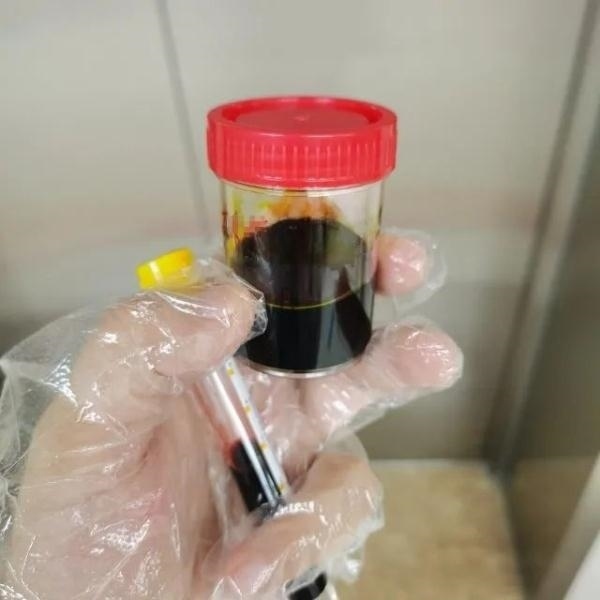 急性肝衰竭！兩兄弟誤吃這種菌 專家提醒